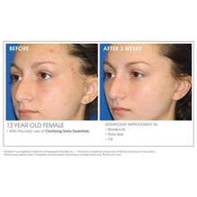 Load image into Gallery viewer, Glowbiotics Acne Clarifying + Refining Treatment
